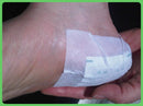 WiseFeet Trial pack of 10 foot patches